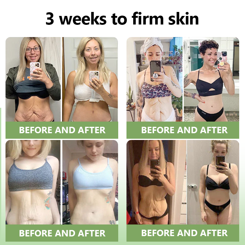 🌟 LOVILDS™𝐋𝐮𝐱𝐮𝐫𝐢𝐨𝐮𝐬 𝐂𝐨𝐥𝐥𝐚𝐠𝐞𝐧 𝐅𝐢𝐫𝐦𝐢𝐧𝐠 𝐂𝐫𝐞𝐚𝐦(🔥70% Off for a Limited Time!)💎