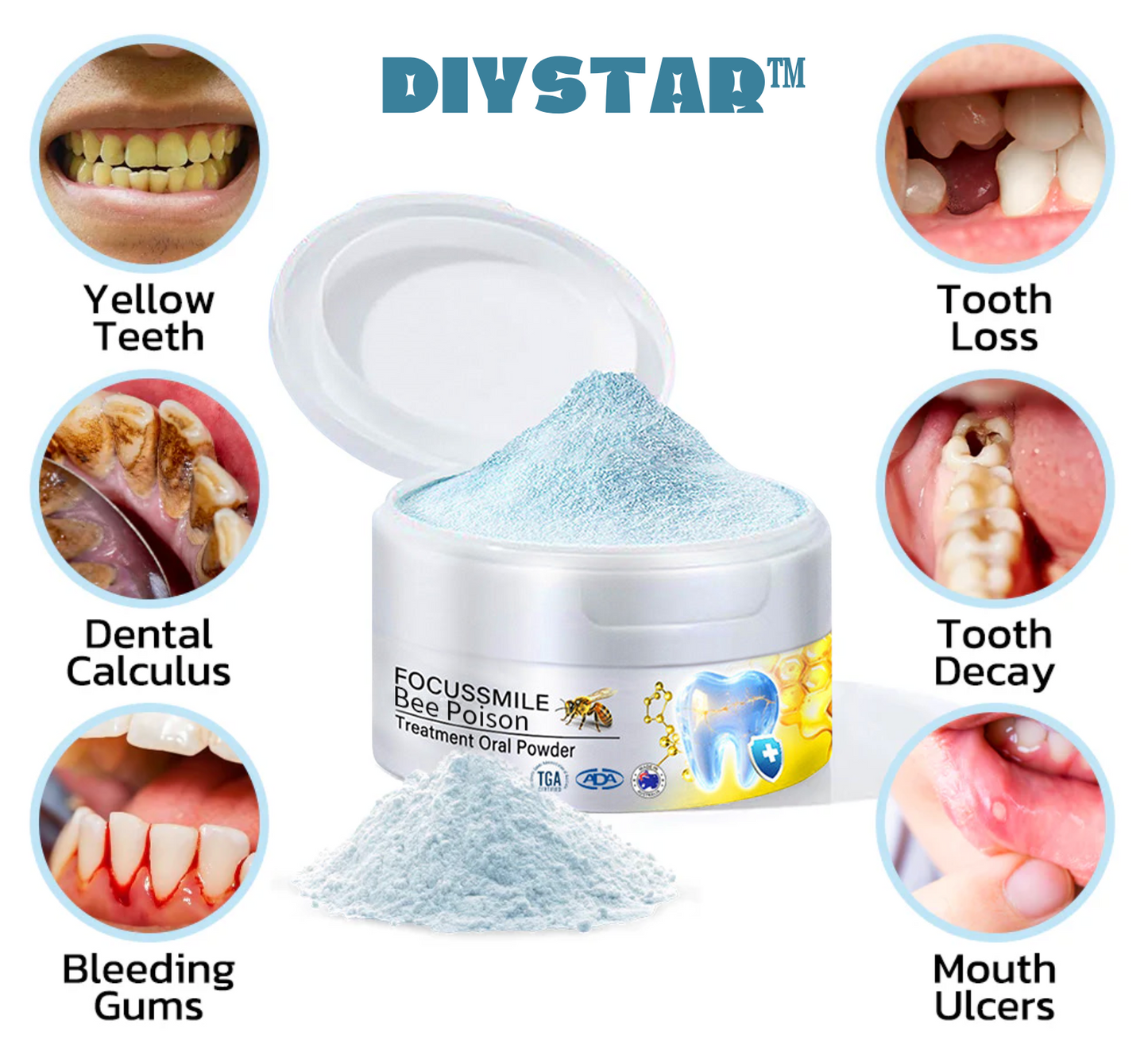 😍 🐝DIYSTAR™ Focussmile Bee Poison Treatment Oral Powder (🇦🇺ADA Recommended)